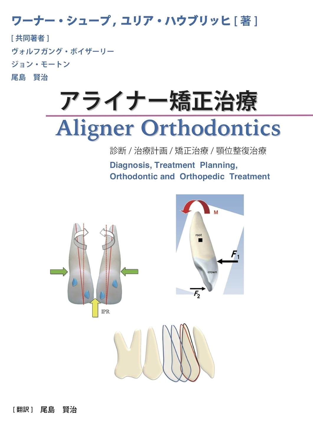 アライナー矯正治療 　 診断/治療計画/矯正治療/顎位整復治療