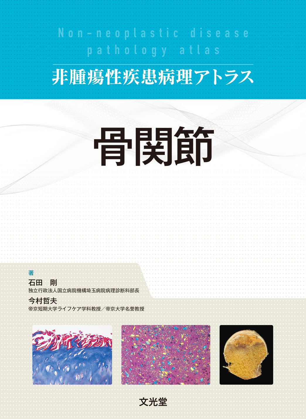 非腫瘍性疾患病理アトラス　骨関節