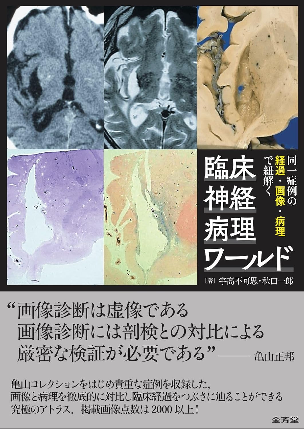 同一症例の経過・画像・病理で紐解く 臨床神経病理ワールド