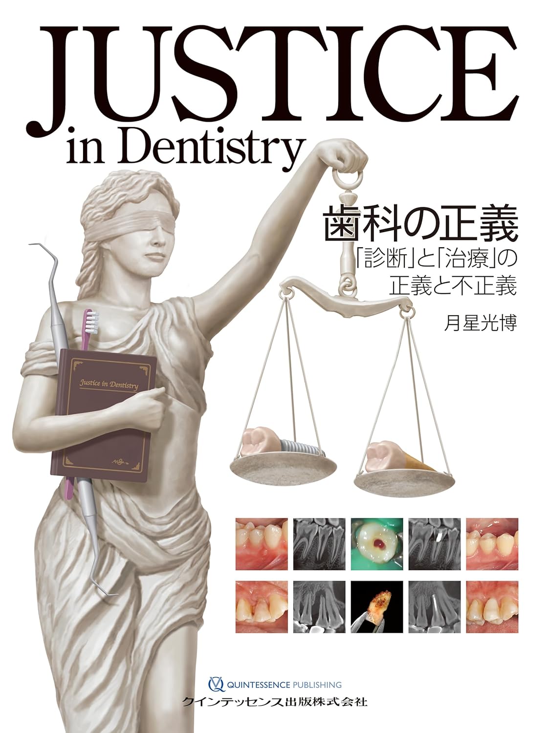 ＪＵＳＴＩＣＥ　ｉｎ　Ｄｅｎｔｉｓｔｒｙ　歯科の正義 「診断」と「治療」の正義と不正義