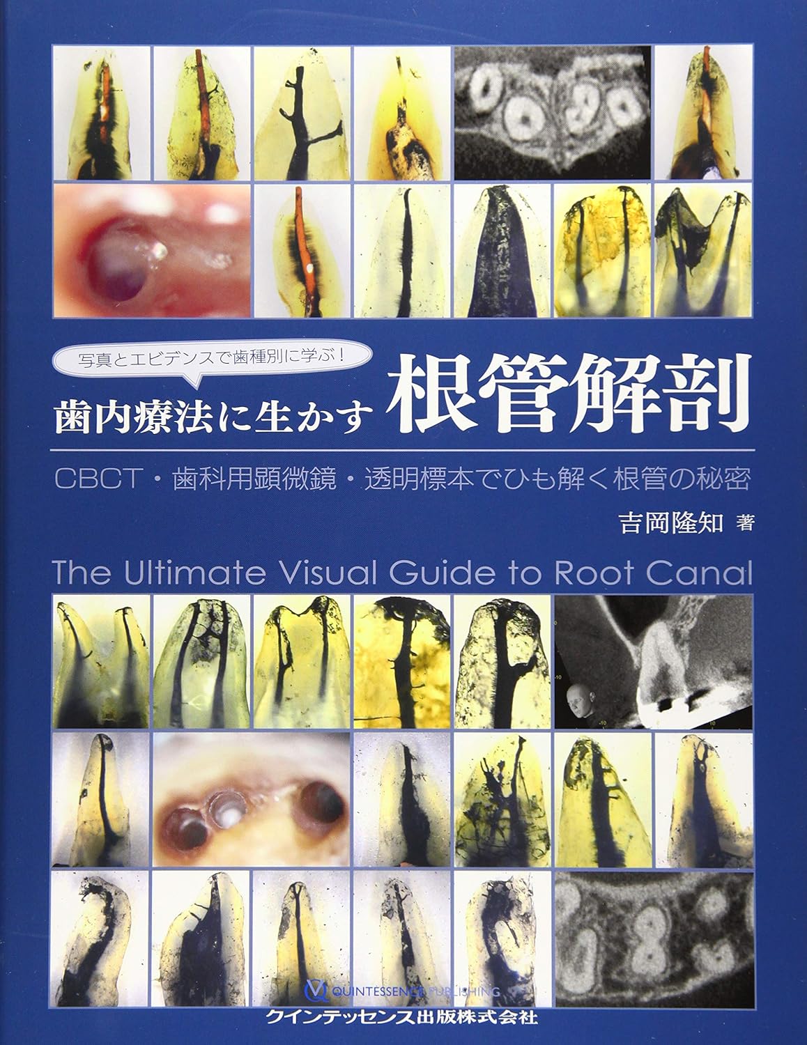 写真とエビデンスで歯種別に学ぶ! 歯内療法に生かす根管解剖